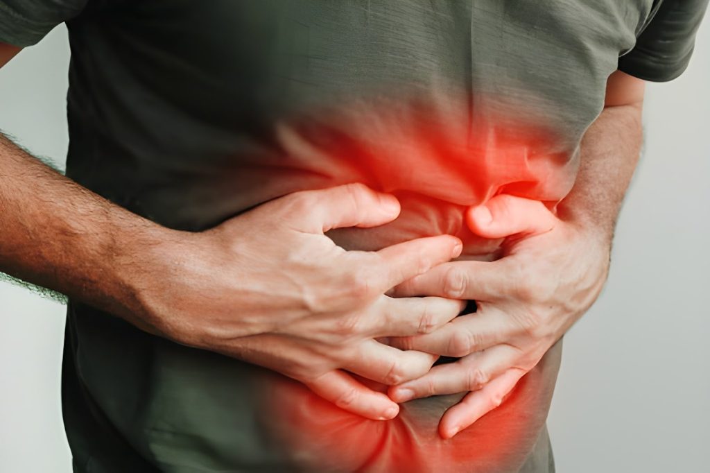 Is Your Acid Reflux Linked To A Hidden Hiatal Hernia?